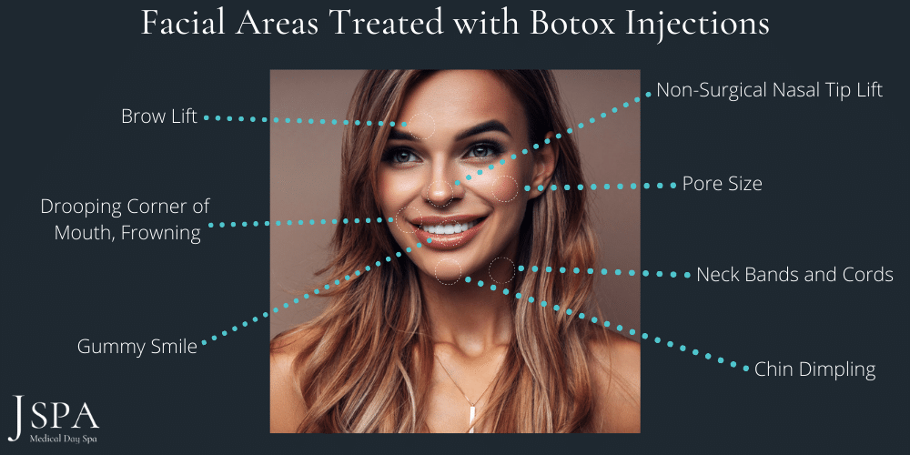 facial area treated with botox injections inforgraphic